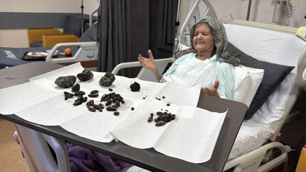 Böylesi görülmedi! Midesinden 63 çekirdek çıkarıldı
