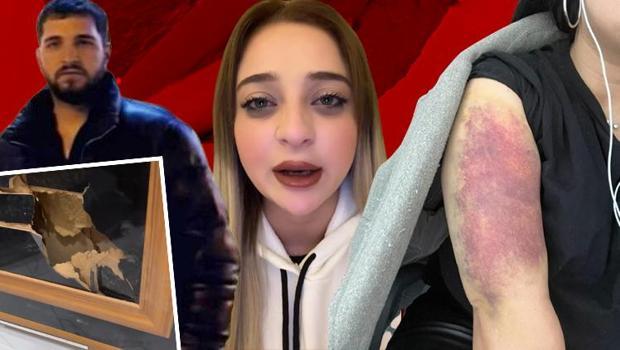 Eski sevgilisi hayatını kararttı! Yaşadığı dehşetti anlattı: 'Böyle video çekeceğim aklıma gelmezdi'