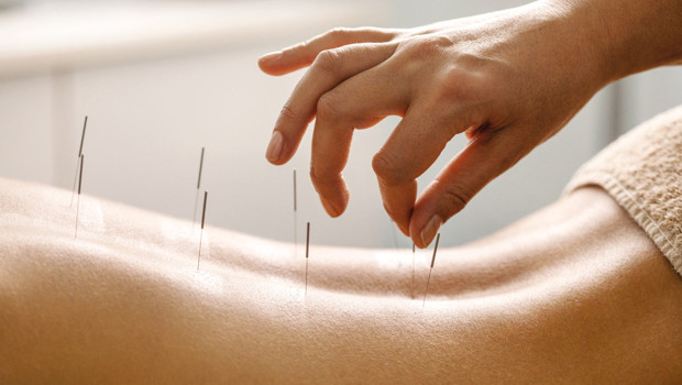MS hastalarına akupunktur tedavisi