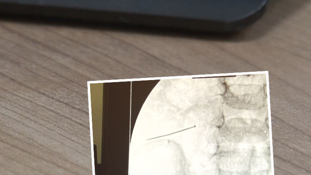 2 yaşındaki çocuk ağrıyla kıvranıyordu... Hastaneye götürülünce bağırsağından çıktı | 'Ölümle sonuçlanabilirdi'