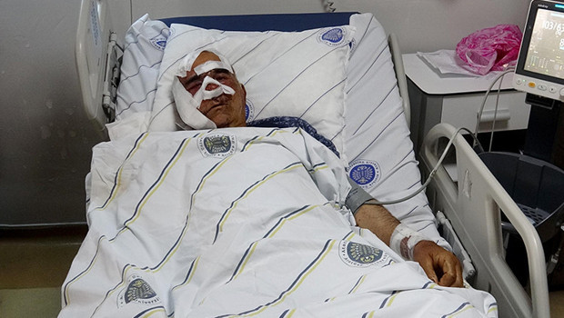 Köyde 5. kez aynı kabus! Yaşlı adama saldırdı, pençe darbeleriyle yüzündeki kemiği kopardı