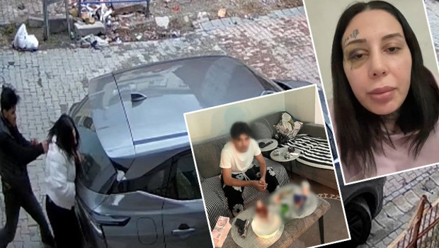 Burun estetiği için para istedi deyip eşini öldüresiye dabetti